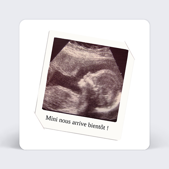 Carte annonce grossesse Échographie Polaroid