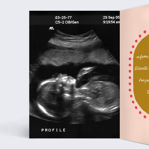 Carte annonce grossesse Jackpot Intérieur Gauche