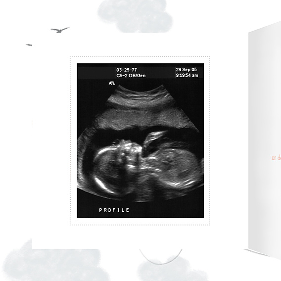 Carte Annonce Grossesse Petits Fruits