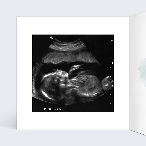 Carte Annonce Grossesse Linge de Famille