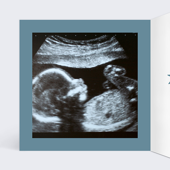 Carte annonce grossesse Jouet Garçon Intérieur Gauche