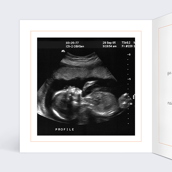 Carte Annonce Grossesse Petite Crevette