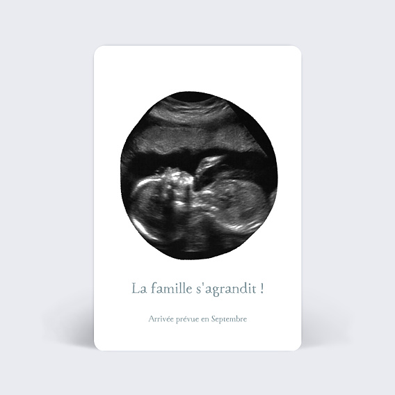 Carte annonce grossesse Échographie Originale