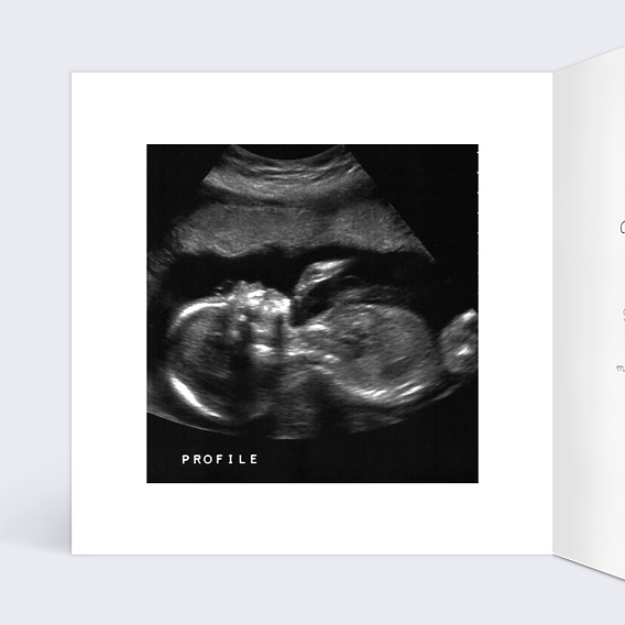 Carte annonce grossesse Bottes de Pluie Intérieur Gauche