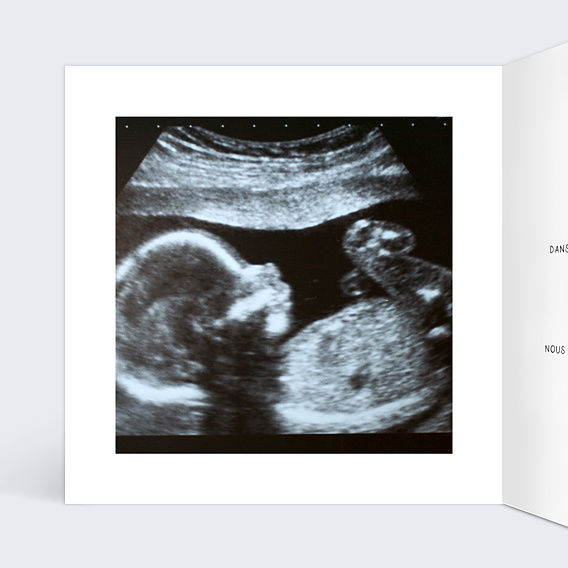 Carte annonce grossesse Couffin Intérieur Gauche