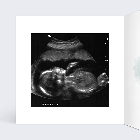 Carte annonce grossesse Linge de Famille Intérieur Gauche