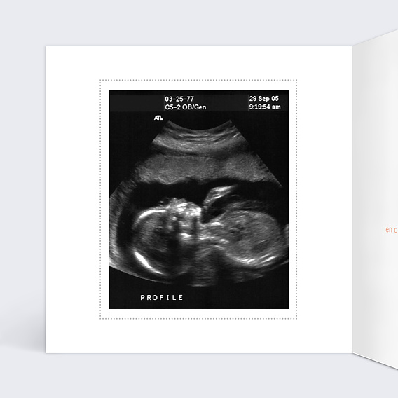 Carte annonce grossesse Petits Fruits Intérieur Gauche