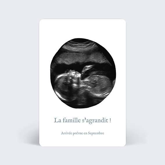 Carte annonce grossesse Échographie Originale