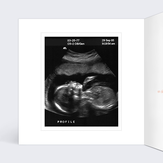 Carte Annonce Grossesse Petits Fruits