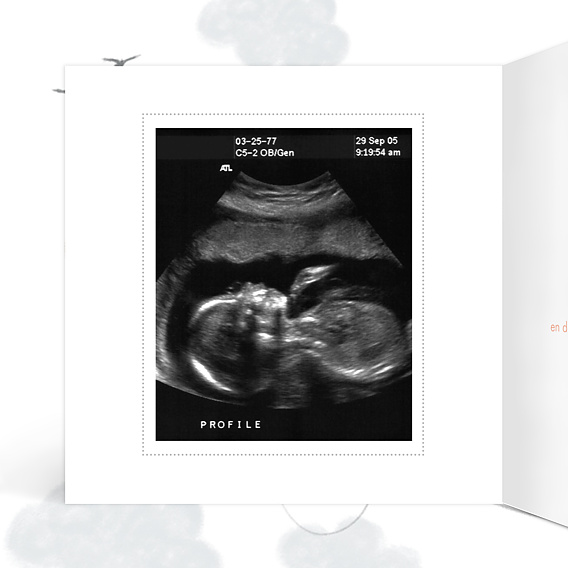 Carte annonce grossesse Petits Fruits Intérieur Gauche