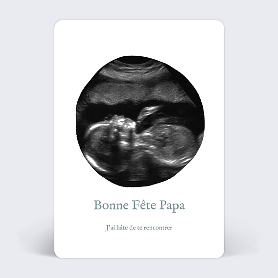 Fête des Pères  Échographie Originale