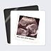 Magnet annonce grossesse Échographie Polaroid