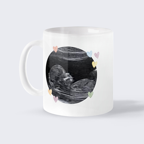 Mug annonce grossesse Surprise, j’arrive