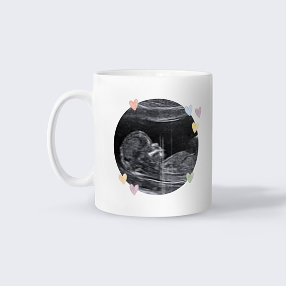 Mug annonce grossesse Surprise, j’arrive
